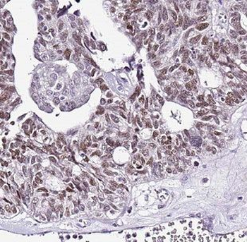 DNAJB11 Antibody