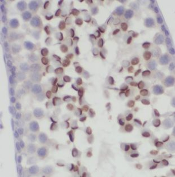 DNAJB13 Antibody