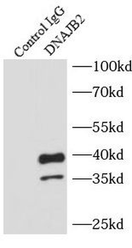 DNAJB2 Antibody