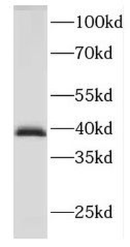 DNAJB2 Antibody