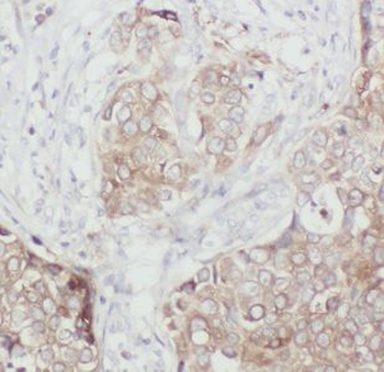 DNAJC1 Antibody