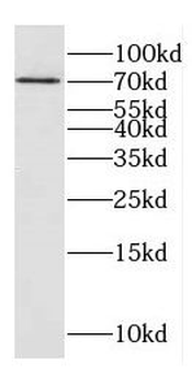 DNAJC21 Antibody