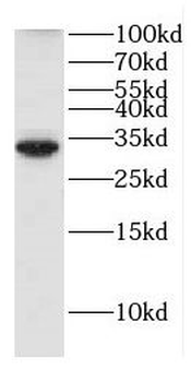 DNAJC27 Rabbit Polyclonal Antibody