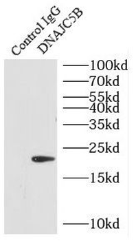 DNAJC5B Rabbit Polyclonal Antibody