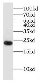 DNAJC5B Rabbit Polyclonal Antibody