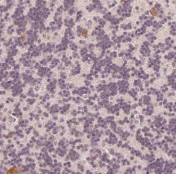 DNAJC6 Antibody