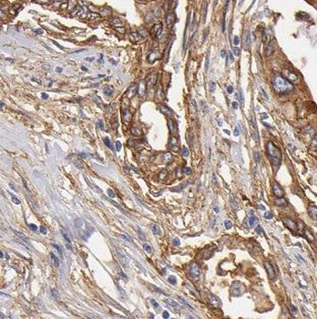 DNAJC7 Antibody
