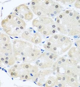 DNAL1 Antibody