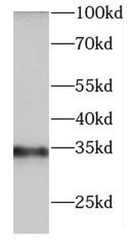 DNASE1L3 Antibody