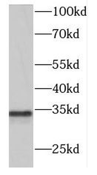 DNASE2 Antibody