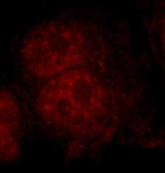 DNMT1 Antibody