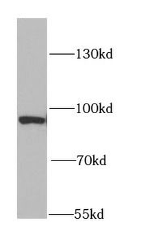DNMT3A Antibody