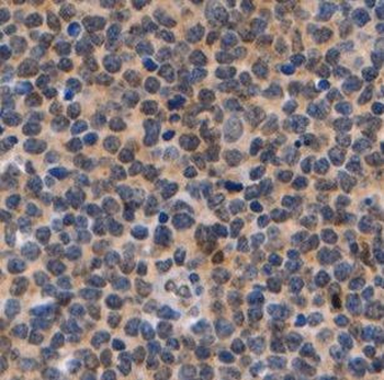 DNTT Antibody