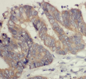 DOCK6 Antibody