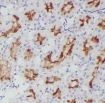 DOCK9 Antibody