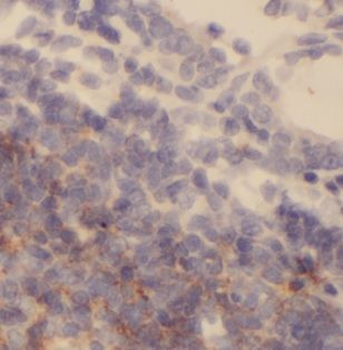DOK2 Rabbit Polyclonal Antibody