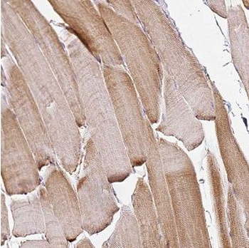 DOK7 Antibody