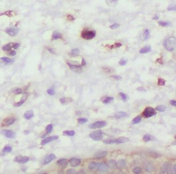 DXO Antibody