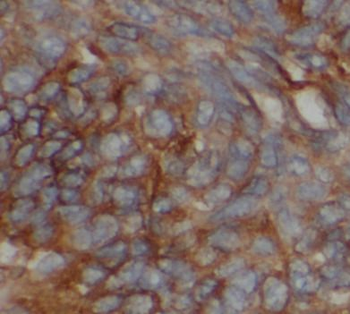 DBH Antibody
