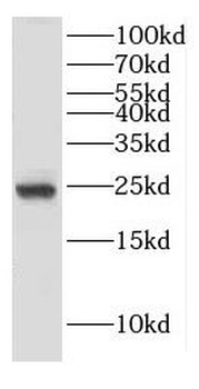 DPCD Antibody