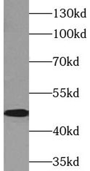 DPEP1 Antibody