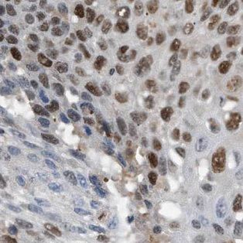 DPF2 Antibody