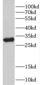 DPM1 Antibody