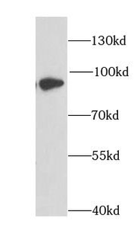 DPP3 Rabbit Polyclonal Antibody