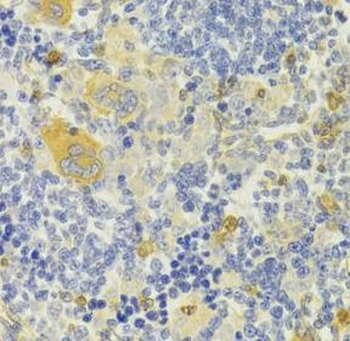 DPP3 Rabbit Polyclonal Antibody