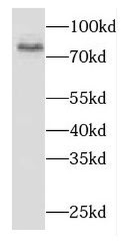 DPP8 Rabbit Polyclonal Antibody