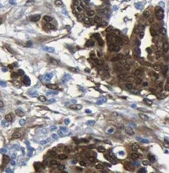 DPP9 Antibody