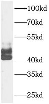 TNFRSF10A Rabbit Polyclonal Antibody