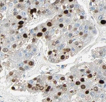 DRAP1 Antibody