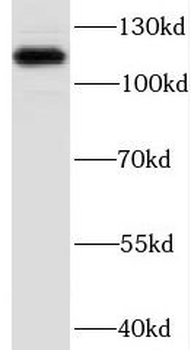 DBN1 Antibody