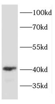 DRG1 Rabbit Polyclonal Antibody