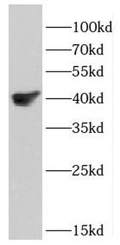 DSN1 Antibody
