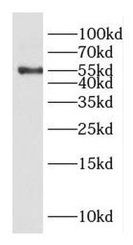 DTNA Rabbit Polyclonal Antibody