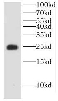 DTYMK Antibody