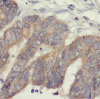 DTYMK Antibody