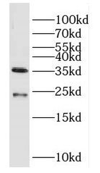 DUSP13B Antibody