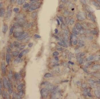 DUSP13B Antibody