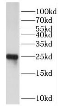 DUSP19 Antibody