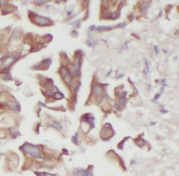 DUSP22 Antibody