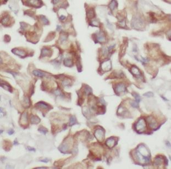 DUSP22 Antibody