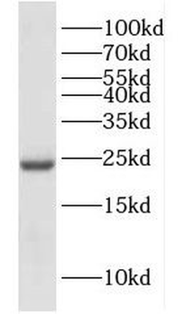 DUT Antibody