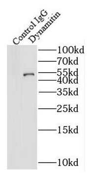 DCTN2 Antibody