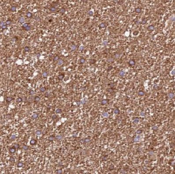 DCTN2 Antibody