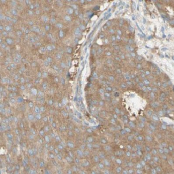 DYNC1H1 Antibody