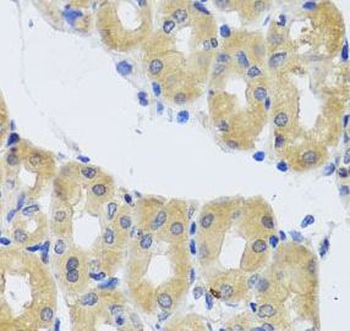 DYNC1I1 Antibody