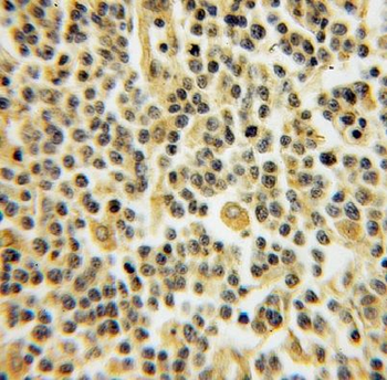 DYRK4 Antibody